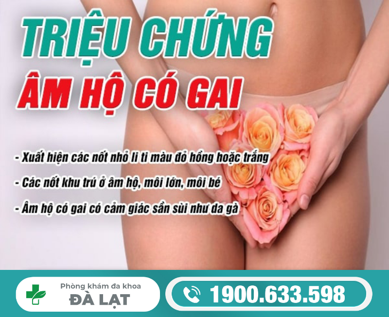 Hình ảnh minh họa